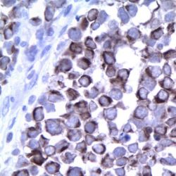 آنتی بادی Cytokeratin 20  برند NOVOCELL