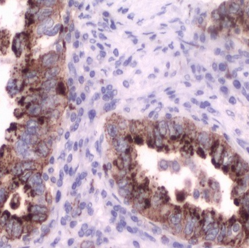 آنتی بادی NapsinA  برند NOVOCELL