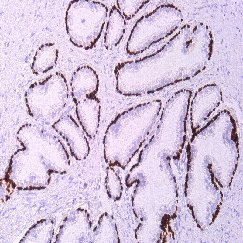 آنتی بادی P63  برند NOVOCELL