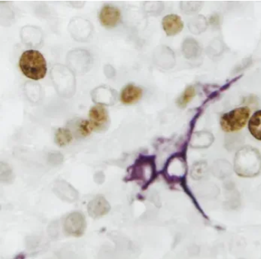 آنتی بادی ثانویه 2Step Detection System  برند NOVOCELL