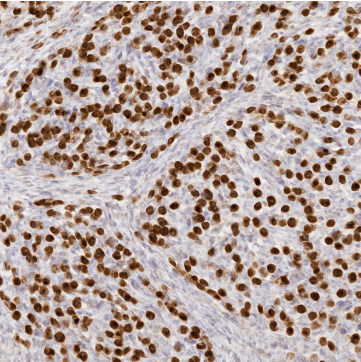 آنتی بادی MSH6 برند NOVOCELL