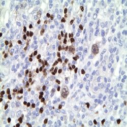 آنتی بادی CD30 برند NOVOCELL